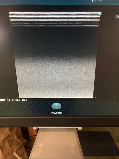 Ultrasound System&nbsp;|&nbsp;FUJIFILM&nbsp;|&nbsp;ARIETTA 50