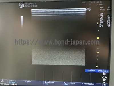 超音波診断装置/カラードプラ | GEヘルスケア・ジャパン株式会社 | LOGIQ V5の写真