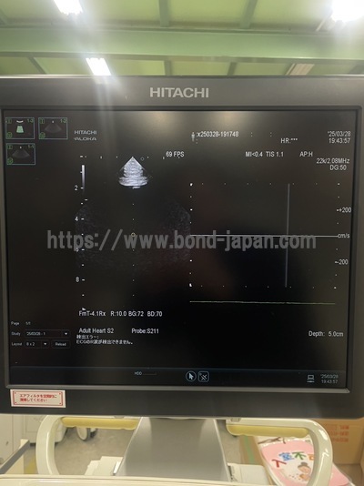 Ultrasound System | HITACHI | ARIETTA 60