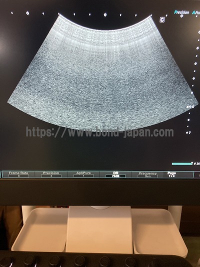 Ultrasound System | CANON | Aplio Go
