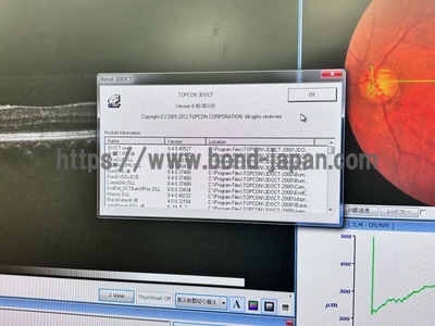 OCT | TOPCON | 3D OCT 1 / Maestro 1