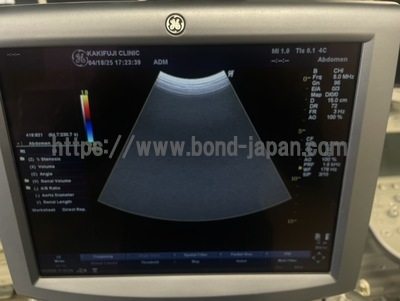 Color Doppler | GE | LOGIQ P5