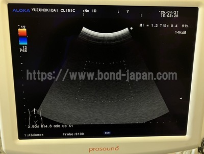 Ultrasound System | HITACHI | Prosound α7