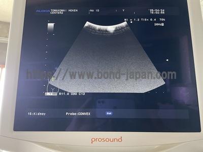 Ultrasound System | HITACHI | Prosound α7