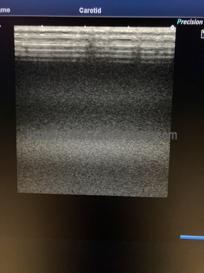 Color Doppler | CANON | Xario 200