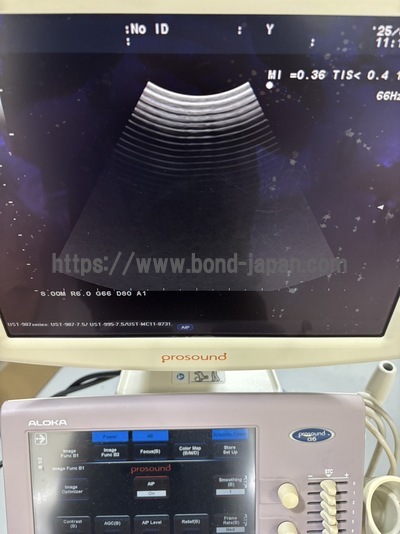 Color Doppler | HITACHI | Prosound α6