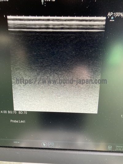 Ultrasound System | HITACHI | ARIETTA 60