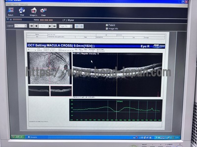 Optical Coherence Tomography ・OCT | NIDEK | RS-3000 Lite