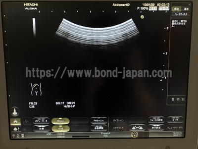 Ultrasound | HITACHI | Noblus