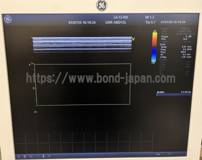 Ultrasound | GE | Vivid T8