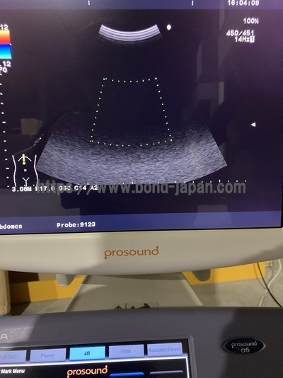 Color Doppler | HITACHI | Prosound α6