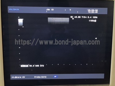 Ultrasound System | HITACHI | Prosound α7