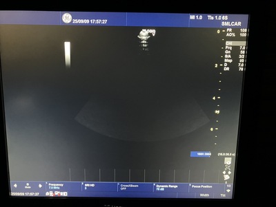 Color Doppler&nbsp;|&nbsp;GE&nbsp;|&nbsp;LOGIQ V5 Expert