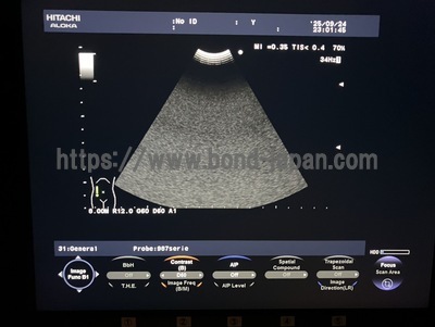 Color Doppler | HITACHI | F37
