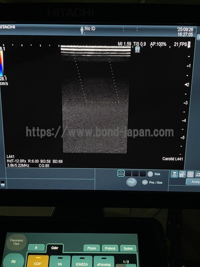 Ultrasound System | FUJIFILM | ARIETTA 850