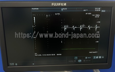 超音波診断装置/カラードプラ&nbsp;|&nbsp;富士フイルムヘルスケア&nbsp;|&nbsp;ARIETTA 65LELVの写真