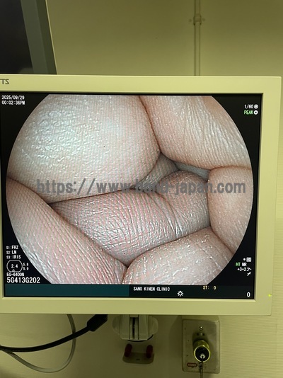 上部消化管経鼻用ビデオスコープ | 富士フイルムメディカル株式会社 | EG-6400Nの写真