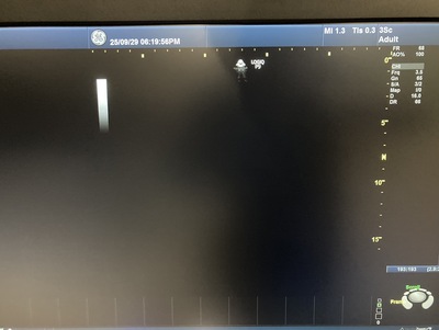 Ultrasound&nbsp;|&nbsp;GE&nbsp;|&nbsp;LOGIQ P9