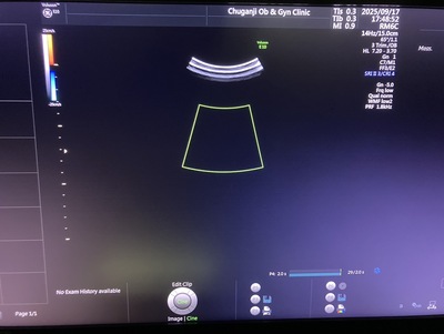 4D Ultrasound&nbsp;|&nbsp;GE&nbsp;|&nbsp;Voluson E10 BT17