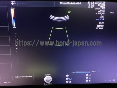 4D Ultrasound | GE | Voluson E10 BT17