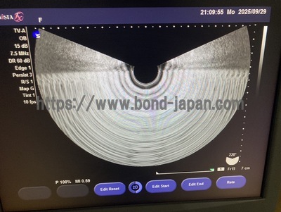 超音波診断装置 | 持田シーメンスメディカルシステム株式会社 | Sonovista FX PEの写真