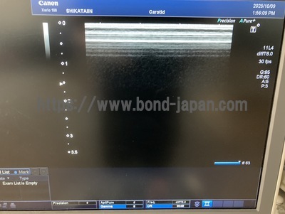 Color Doppler | CANON | TUS-X100 Xario 100