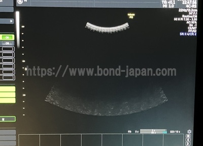 Ultrasound | GE | Voluson P8 BT18