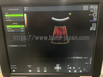 Ultrasound | GE | Voluson P8 BT18