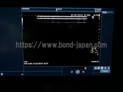 Ultrasound System&nbsp;|&nbsp;FUJIFILM&nbsp;|&nbsp;ARIETTA 850