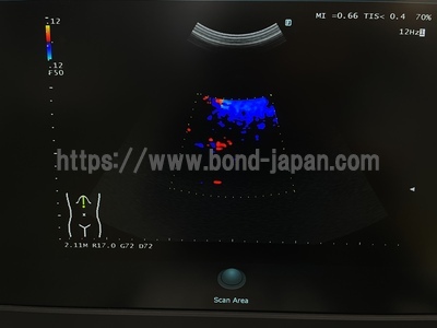 超音波診断装置&nbsp;|&nbsp;富士フィルムヘルスケア株式会社&nbsp;|&nbsp;ARIETTA 50の写真