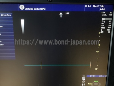 Color Doppler | GE | Logiq S7 Expert