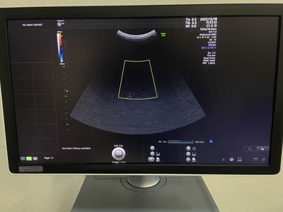 4D Ultrasound&nbsp;|&nbsp;GE&nbsp;|&nbsp;Voluson E10 BT18