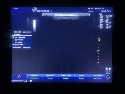 Color Doppler&nbsp;|&nbsp;GE&nbsp;|&nbsp;LOGIQ P5