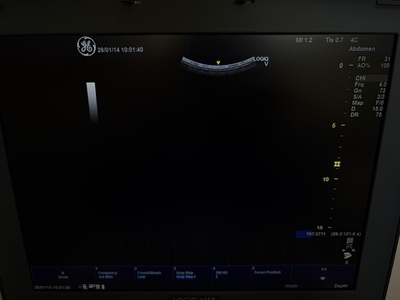 Color Doppler&nbsp;|&nbsp;GE&nbsp;|&nbsp;LOGIQ e V2