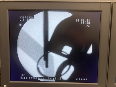 C-Arm&nbsp;|&nbsp;SIEMENS&nbsp;|&nbsp;Siremobile Compact L