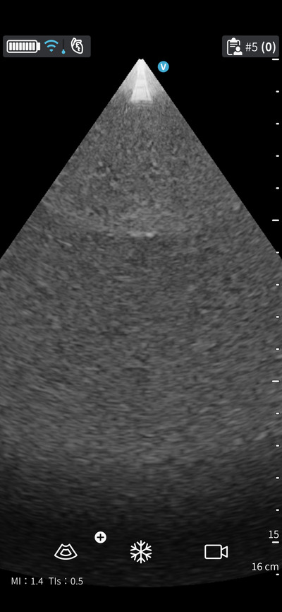 汎用超音波画像診断装置&nbsp;|&nbsp;GEヘルスケア・ジャパン株式会社&nbsp;|&nbsp;Vscan Air SLの写真
