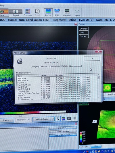 Retinal Camera and OCT Combined&nbsp;|&nbsp;TOPCON&nbsp;|&nbsp;3D OCT 1 / Maestro 1