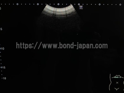 超音波診断装置/カラードプラ | キャノンメディカル株式会社 | Aplio 300の写真