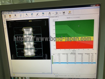 X-ray Bone Densitometer | GE | DPX BRAVO