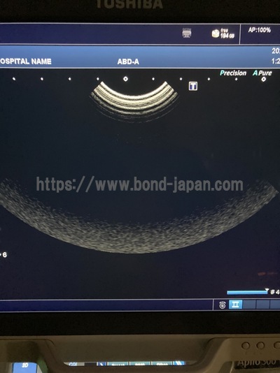 超音波診断装置/カラードプラ | キャノンメディカル株式会社 | Aplio 300の写真