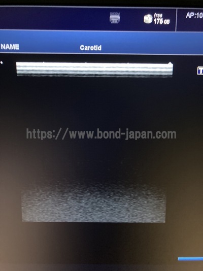 超音波診断装置/カラードプラ | キャノンメディカル株式会社 | TUS-X100 Xario 100の写真