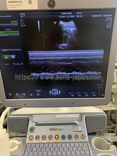 4D Ultrasound | GE | Voluson S8