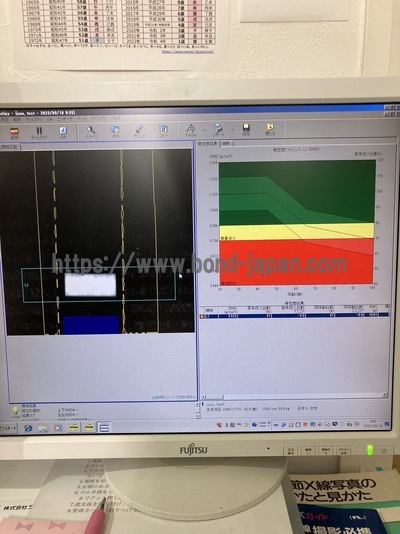 X-ray Bone Densitometer | GE | Prodigy