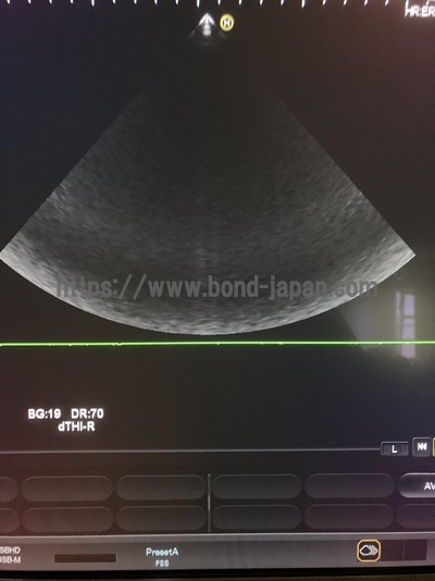 Color Doppler | HITACHI | Hi Vision Preirus