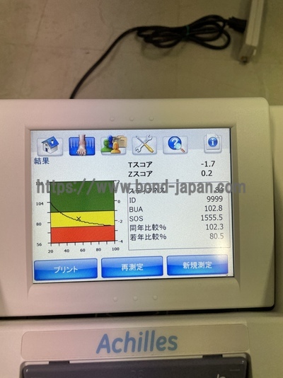 Bone Densitometry | GE | A-1000 EXP II