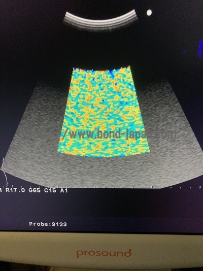Color Doppler | HITACHI | Prosound α6