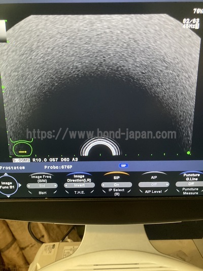 Color Doppler | HITACHI | F37