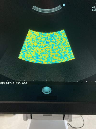 Ultrasound System&nbsp;|&nbsp;FUJIFILM&nbsp;|&nbsp;ARIETTA 50