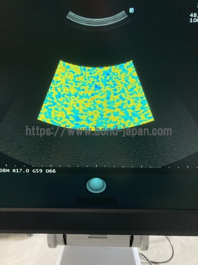 Ultrasound System | FUJIFILM | ARIETTA 50