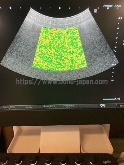 Ultrasound System | CANON | Aplio Go